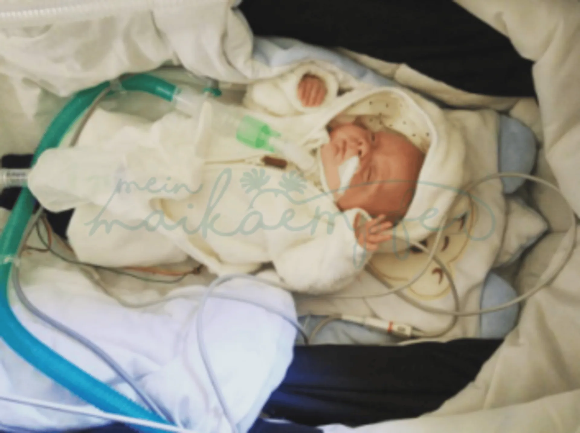 Raphael, unser Maikaempfer, im Kinderwagen, vollbeatmet und mit Sensoren ausgestattet - Unsere Geschichte von meinmaikaempfer®